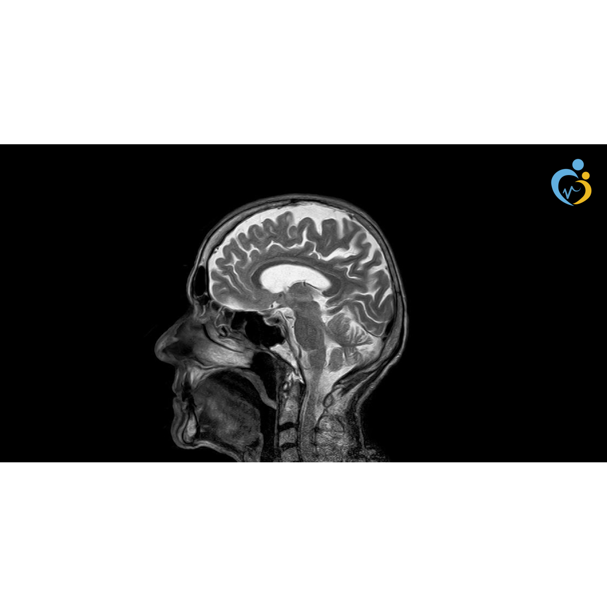 التصوير المقطعي المحوسب Ct استخداماته ميزاته ومخاطره